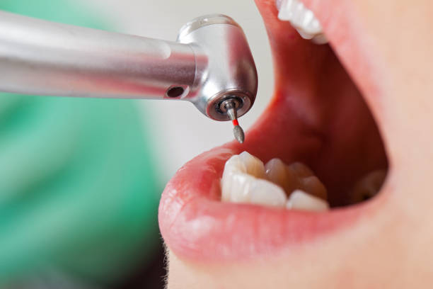 Best Emergency Broken Tooth Repair in Milton, NY
